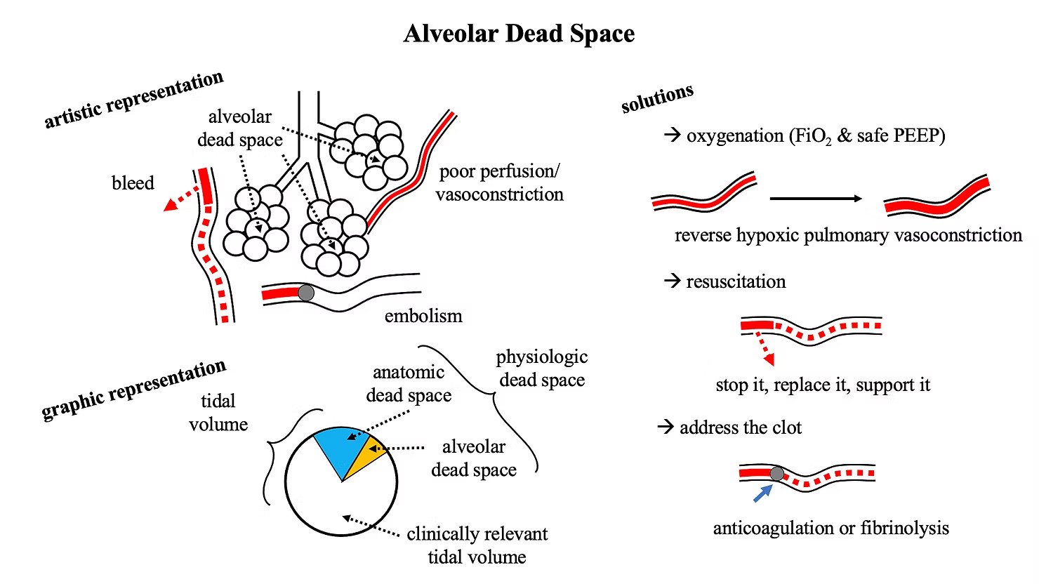 alveolar dead space