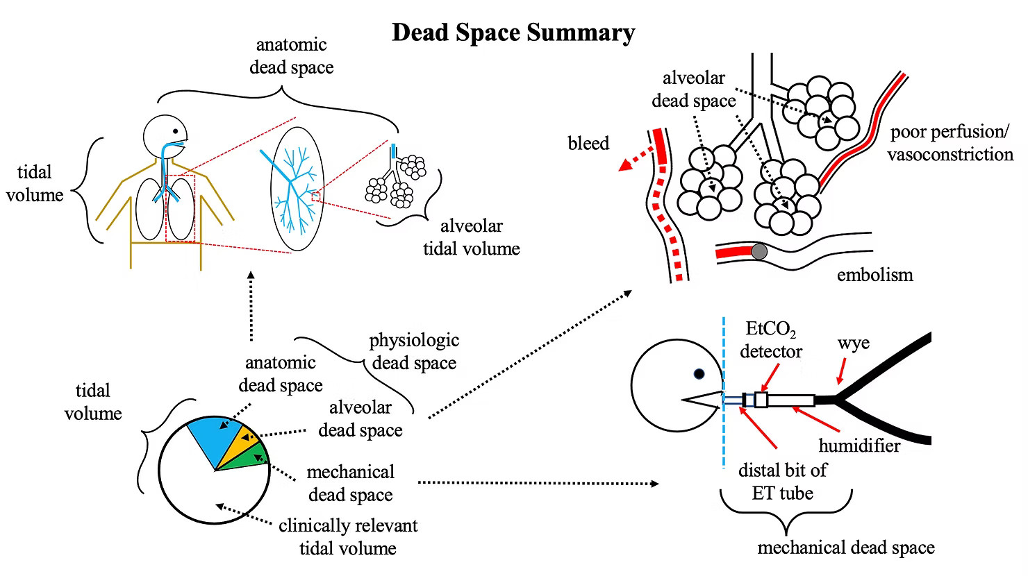 dead space summary