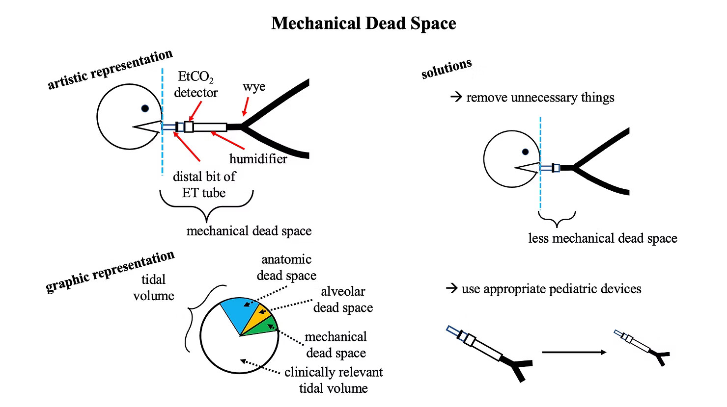 mechanical dead space