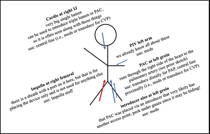 hemodynamic sketches
