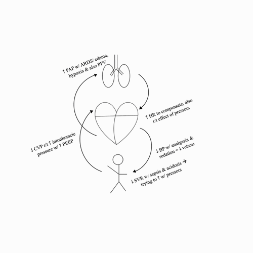 hemodynamic sketches