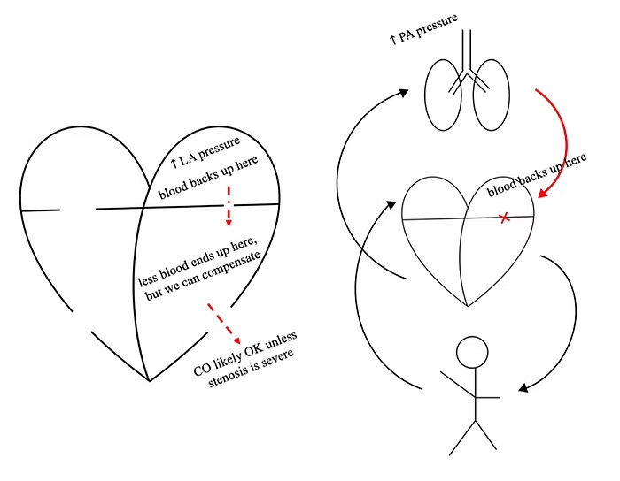 hemodynamic sketches